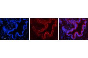 PIGF antibody - N-terminal region          Formalin Fixed Paraffin Embedded Tissue:  Human Bronchial Epithelial Tissue    Observed Staining:  Cytoplasm in Human Bronchial Epithelial Tissue   Primary Antibody Concentration:  1:100    Secondary Antibody:  Donkey anti-Rabbit-Cy3    Secondary Antibody Concentration:  1:200    Magnification:  20X    Exposure Time:  0. (PIGF 抗体  (N-Term))
