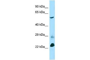 Host: Rabbit Target Name: Btbd3 Sample Type: Mouse Lung lysates Antibody Dilution: 1. (BTBD3 抗体  (C-Term))