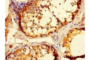 Immunohistochemistry of paraffin-embedded human testis tissue using ABIN7173195 at dilution of 1:100 (TMEM27 抗体  (AA 206-265))