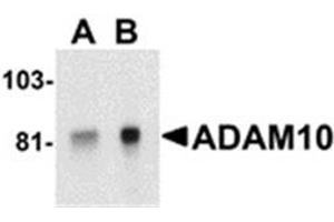 Image no. 1 for anti-ADAM Metallopeptidase Domain 10 (ADAM10) (AA 732-748) antibody (ABIN319033) (ADAM10 抗体  (AA 732-748))