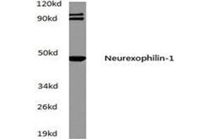 Western blot (WB) analysis of Neurexophilin-1 antibody in extracts from A549 cells at 1/500 dilution. (Neurexophilin 1 抗体)