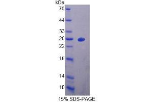 SDS-PAGE of Protein Standard from the Kit  (Highly purified E. (Vitamin D-Binding Protein ELISA 试剂盒)