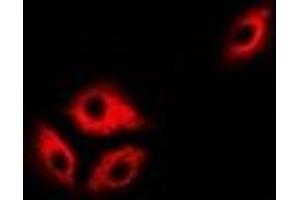 Immunofluorescent analysis of ASL staining in Hela cells. (ASL 抗体)