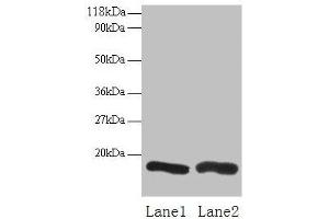 Western blot All lanes: CHMP2A antibody at 2 μg/mL Lane 1: EC109 whole cell lysate Lane 2: 293T whole cell lysate Secondary Goat polyclonal to rabbit IgG at 1/15000 dilution Predicted band size: 26 kDa Observed band size: 16 kDa (CHMP2A 抗体  (AA 1-222))