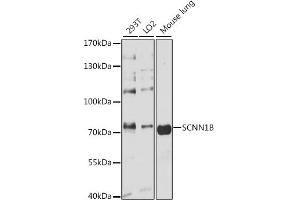 Western blot analysis of extracts of various cell lines, using SCNN1B antibody (ABIN3022509, ABIN3022510, ABIN1513502 and ABIN6218866) at 1:3000 dilution. (SCNN1B 抗体  (AA 406-640))