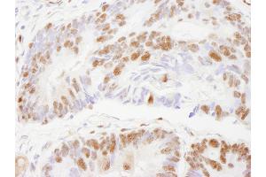 Immunohistochemistry (IHC) image for anti-Zinc Finger Protein 295 (ZNF295) (AA 875-925) antibody (ABIN7448882) (ZNF295 抗体  (AA 875-925))