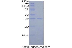 SDS-PAGE (SDS) image for Cardiac Troponin I (TNNI3) (AA 1-211) protein (His tag) (ABIN1081044)