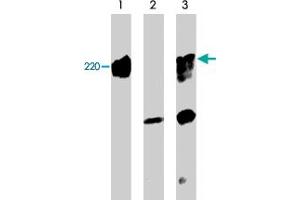 Western blots showing mouse brain (lane 1), and COS-7 cells untransfected (lane 2) or transfected with mouse myc-tagged PLXNA1 (lane 3).