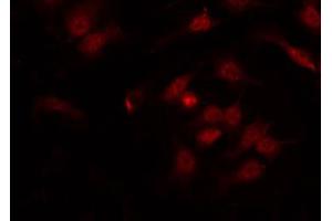 ABIN6267647 staining HT29 by IF/ICC. (IRF3 抗体  (pSer386))