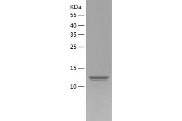 KCNV2 Protein (AA 12-154) (His tag)