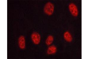 ABIN6267569 staining HUVEC cells treated with serum 20% 30' by ICC/IF. (PRKDC 抗体  (pThr2647))