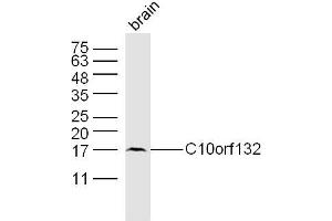 Mouse brain lysates probed with C10orf132 Polyclonal Antibody, Unconjugated  at 1:300 dilution and 4˚C overnight incubation.