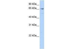 WB Suggested Anti-MEF2A Antibody Titration:  0. (MEF2A 抗体  (Middle Region))
