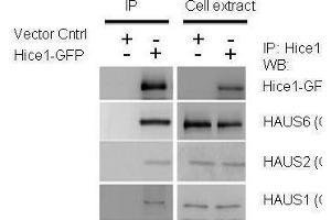 Immunoprecipitation (IP) image for anti-HAUS Augmin-Like Complex, Subunit 8 (HAUS8) antibody (ABIN2854852)