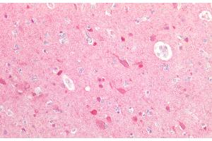 Detection of UBQLN2 in Human Brain Tissue using Polyclonal Antibody to Ubiquilin 2 (UBQLN2) (Ubiquilin 2 抗体  (AA 33-126))