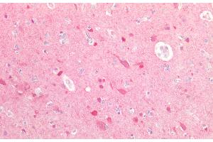 Detection of UBQLN2 in Human Brain Tissue using Polyclonal Antibody to Ubiquilin 2 (UBQLN2) (Ubiquilin 2 抗体  (AA 33-126))