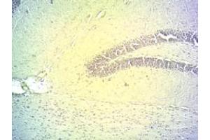 ABIN190862 (2µg/ml) staining of PFA-fixed cryo-sectioned Mouse Hippocampus. (DIO2 抗体  (Internal Region))