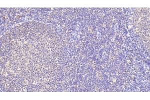 Detection of TFR in Porcine Lymph node Tissue using Polyclonal Antibody to Transferrin Receptor (TFR) (Transferrin Receptor 抗体  (AA 578-765))