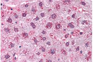 Human Liver (formalin-fixed, paraffin-embedded) stained with CAT antibody ABIN214024 at 5 ug/ml followed by biotinylated goat anti-rabbit IgG secondary antibody ABIN481713, alkaline phosphatase-streptavidin and chromogen. (Catalase 抗体)