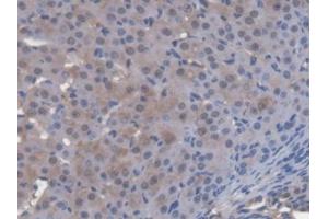 DAB staining on IHC-P; Samples: Mouse Ovary Tissue (ENOX2 抗体  (AA 1-207))