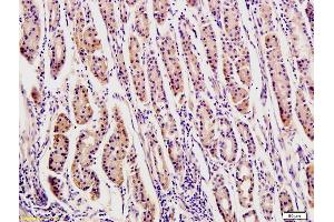 Formalin-fixed and paraffin-embedded human stomach tissue labeled with Rabbit Anti-OPN Polyclonal Antibody, Unconjugated (ABIN723695) at 1:200 followed by conjugation to the secondary antibody and DAB staining (Osteopontin 抗体  (AA 141-220))