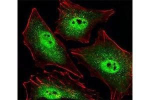 Fluorescent image of A549 cells stained with SIRT1 antibody. (SIRT1 抗体  (AA 566-601))