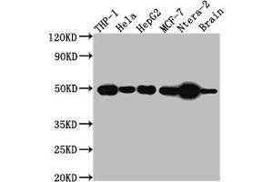 Western Blot Positive WB detected in: THP-1 whole cell lysate, Hela whole cell lysate, HepG2 whole cell lysate, MCF-7 whole cell lysate, Ntera-2 whole cell lysate, Mouse Brain whole cell lysate All lanes: TACR1 antibody at 1:1000 Secondary Goat polyclonal to rabbit IgG at 1/50000 dilution Predicted band size: 47, 36 kDa Observed band size: 50 kDa (Recombinant TACR1 抗体)