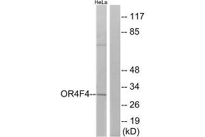 Western blot analysis of extracts from HeLa cells, using OR4F4 antibody. (OR4F4 抗体  (C-Term))