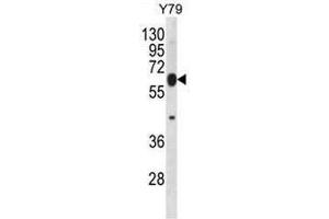 RNF180 Antibody (C-term) western blot analysis in Y79 cell line lysates (35µg/lane). (RNF180 抗体  (C-Term))