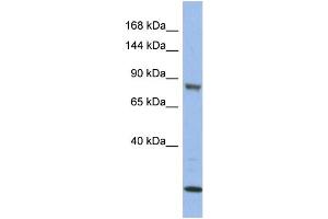 WB Suggested Anti-MAP3K11  Antibody Titration: 0. (MAP3K11 抗体  (Middle Region))