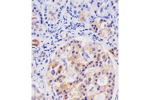 A staining HHLA2 in human pancreas tissue sections by Immunohistochemistry (IHC-P - paraformaldehyde-fixed, paraffin-embedded sections). (HHLA2 抗体  (AA 58-87))