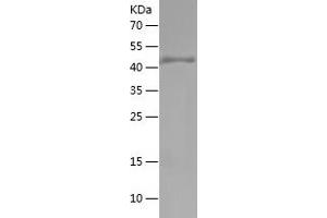 Occludin Protein (OCLN) (AA 270-441) (His-IF2DI Tag)
