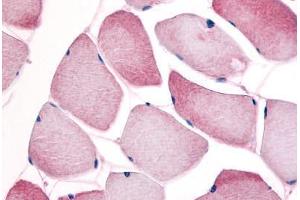 Human Skeletal Muscle (formalin-fixed, paraffin-embedded) stained with CCNL1 antibody ABIN214640 at 10 ug/ml followed by biotinylated goat anti-rabbit IgG secondary antibody ABIN481713, alkaline phosphatase-streptavidin and chromogen. (Cyclin L1 抗体)