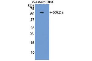 Western Blotting (WB) image for anti-Proteasome (Prosome, Macropain) 26S Subunit, ATPase, 3 (PSMC3) (AA 2-439) antibody (ABIN1860336) (PSMC3 抗体  (AA 2-439))