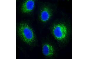 Immunofluorescent analysis of 4 % paraformaldehyde-fixed, 0. (FADS2 抗体)