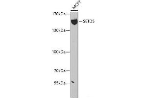 Western blot analysis of extracts of MCF-7 cells using SETD5 Polyclonal Antibody at dilution of 1:300. (SETD5 抗体)