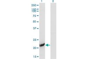 Western Blot analysis of GUK1 expression in transfected 293T cell line by GUK1 monoclonal antibody (M02A), clone 1H3.