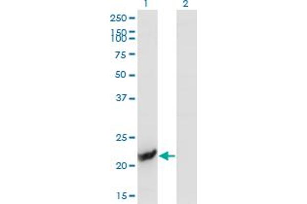 GUK1 anticorps  (AA 100-197)