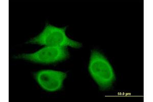 Immunofluorescence of purified MaxPab antibody to CAST on HeLa cell. (Calpastatin 抗体  (AA 1-667))
