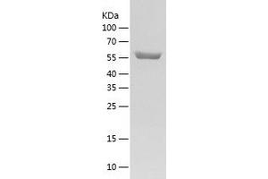 CPNE1 Protein (AA 1-537) (His tag)