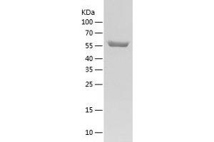 Western Blotting (WB) image for Copine I (CPNE1) (AA 1-537) protein (His tag) (ABIN7288510) (CPNE1 Protein (AA 1-537) (His tag))