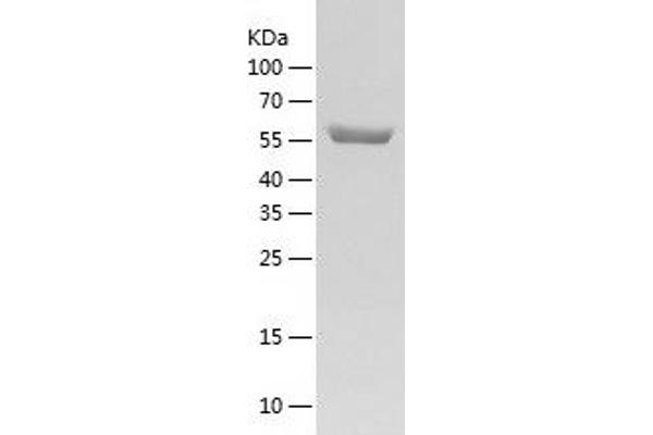 CPNE1 Protein (AA 1-537) (His tag)