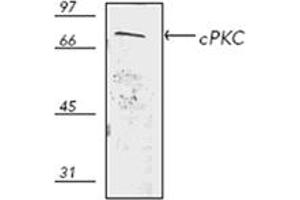 Western blot analysis of human thymus HS67 cell lysate, probed with PKC pAb. (PKC 抗体)