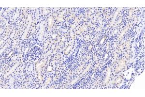 Detection of WWP2 in Human Kidney Tissue using Polyclonal Antibody to WW Domain Containing E3 Ubiquitin Protein Ligase 2 (WWP2) (WWP2 抗体  (AA 601-870))