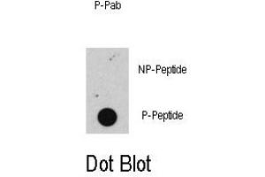 Image no. 1 for anti-Retinoblastoma 1 (RB1) (pSer608) antibody (ABIN358211) (Retinoblastoma 1 抗体  (pSer608))