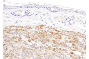 Immunohistochemistry (IHC) image for anti-Isocitrate Dehydrogenase 2 (NADP+), Mitochondrial (IDH2) (AA 402-452) antibody (ABIN7455220) (IDH2 抗体  (AA 402-452))