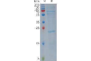 SDS-PAGE (SDS) image for NLR Family, Pyrin Domain Containing 3 (NLRP3) (AA 2-1036) protein (DYKDDDDK Tag) (ABIN6964301)