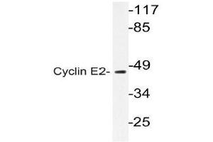 Western blot (WB) analysis of Cyclin E2 antibody in extracts from Jurkat cell. (Cyclin E2 抗体)