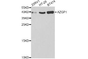 Western blot analysis of extracts of various cell lines, using AZGP1 antibody (ABIN5973101) at 1/1000 dilution. (AZGP1 抗体)