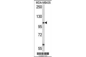 Western blot analysis of CASD1 Antibody in MDA-MB435 cell line lysates (35ug/lane) (CASD1 抗体  (N-Term))